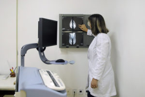 DF reduz fila de mamografia em mais de 70% com ampliação do serviço