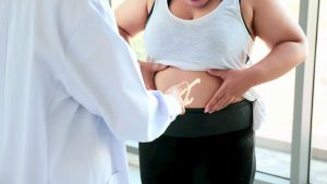 Especialista tira dúvidas sobre cirurgia bariátrica durante a pandemia