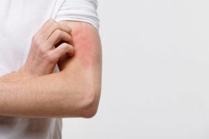 Alergia na pele? Dermatologista explica causas e tratamentos para o problema
