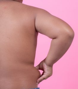 Obesidade aumenta o risco de doenças cardiovasculares