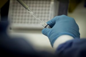Lacen acompanha queda dos casos de covid-19 no DF