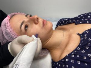 Skinbooster: tratamento é alternativa para recuperar a pele durante a seca