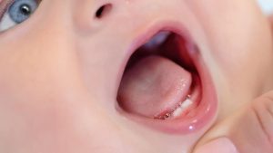 Odontopediatra dá dicas de como aliviar o desconforto dos primeiros dentes em bebês