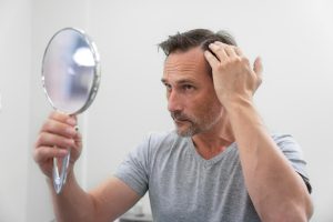 Homens têm ficado calvos mais cedo aponta pesquisa