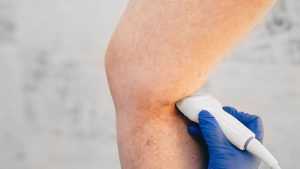 Agosto Azul Vermelho alerta para cuidados com as doenças vasculares