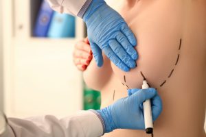 Aumento do seios foi a cirurgia mais procurada no mundo, segundo pesquisa