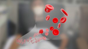 Segundo estudo, uso regular da imunoglobulina intravenosa reduz internações