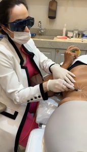 Harmonização facial e corporal ganham técnica exclusiva que garante maior segurança e promove uma medicina regenerativa