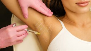 Suor excessivo: é possível resolver o problema com botox?