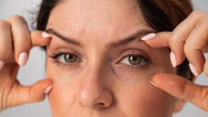 Blefaroplastia é a cirurgia facial mais realizada no Brasil
