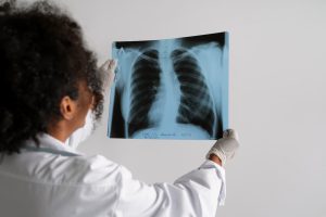 Inverno aumenta riscos de doenças respiratórias: exames de imagem podem indicar diagnóstico precoce