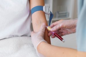 Colesterol elevado: um inimigo silencioso da saúde cardiovascular