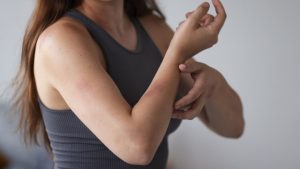 Aumento de casos de dengue, zika e chikungunya no verão reforça a importância do diagnóstico rápido e preciso