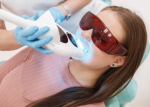 Fitas clareadoras, receitas caseiras e produtos sem procedência podem comprometer a saúde bucal em busca de dentes mais brancos